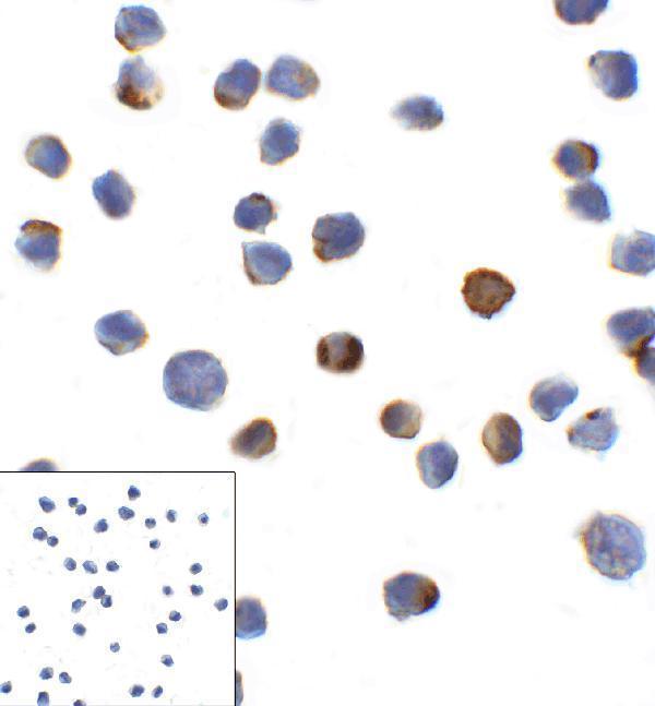 Immunocytochemistry of LAG-3 in over expressing HEK293 cells using LAG-3 antibody and control mouse IgG antibody (left corner box) at 1 μg/ml