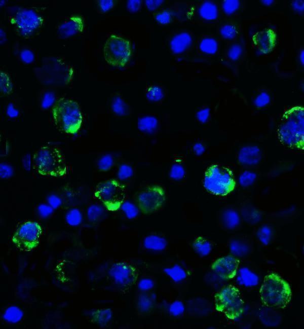 Immunofluorescence of LAG-3 in over expressing HEK293 cells using LAG-3 Antibody at 2 μg/ml