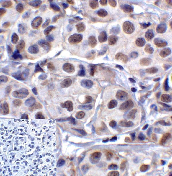 m02869 1 lag3 primary antibodies ihc testing 5