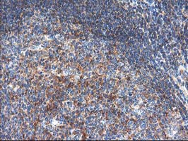 Immunohistochemical staining of paraffin-embedded Human tonsil within the normal limits using anti-TFG mouse monoclonal antibody. (Heat-induced epitope retrieval by 10mM citric buffer