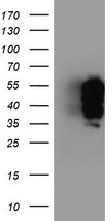 m02870 1 anti trk fused gene tfg mouse monoclonal antibody clone id oti2c3 wb testing 1