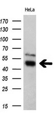 m02870 1 anti trk fused gene tfg mouse monoclonal antibody clone id oti2c3 wb testing 2
