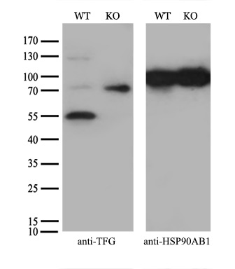 m02870 1 anti trk fused gene tfg mouse monoclonal antibody clone id oti2c3 wb testing 3
