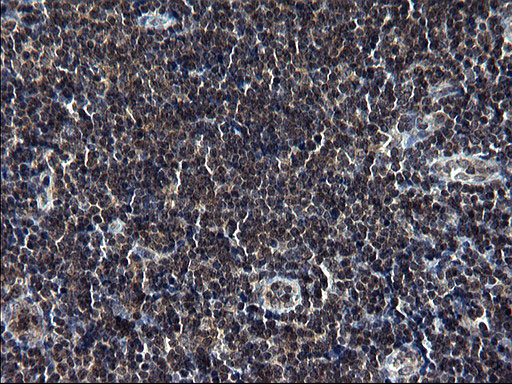 Immunohistochemical staining of paraffin-embedded Human lymph node tissue within the normal limits using anti-TBX1 mouse monoclonal antibody