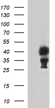 HEK293T cells were transfected with the pCMV6-ENTRY control (Left lane) or pCMV6-ENTRY TBX1 (Right lane) cDNA for 48 hrs and lysed