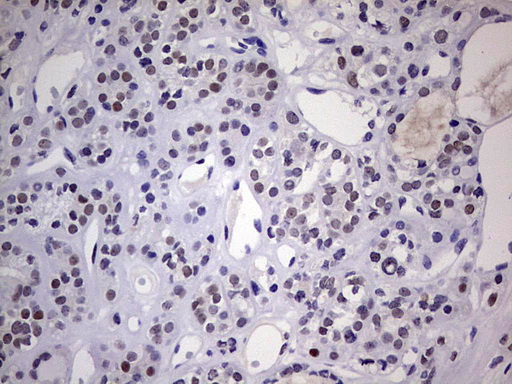 m02873 anti nab2 mouse monoclonal antibody clone id oti5d7 ihc testing 2
