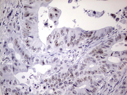 m02873 anti nab2 mouse monoclonal antibody clone id oti5d7 ihc testing 4