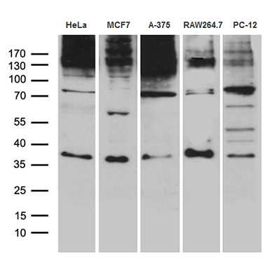 Western blot analysis of extracts (35ug) from 5 different cell lines by using anti-RNF4 monoclonal antibody (1:500)