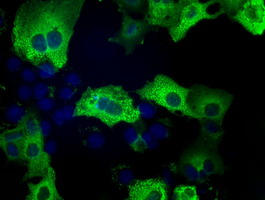m02876 2 anti tacc3 mouse monoclonal antibody clone id oti1e11 if testing 5