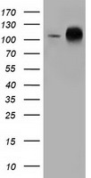 HEK293T cells were transfected with the pCMV6-ENTRY control (Left lane) or pCMV6-ENTRY TACC3 (Right lane) cDNA for 48 hrs and lysed