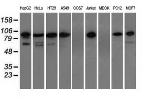 Western blot analysis of extracts (35ug) from 9 different cell lines by using anti-TACC3 monoclonal antibody