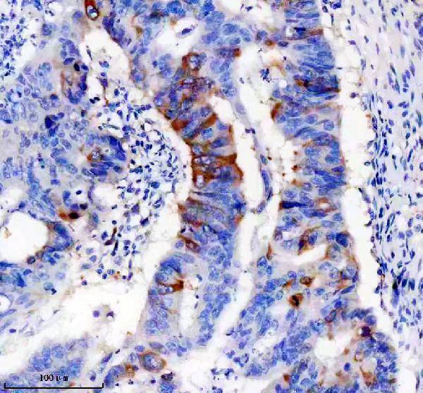 IHC analysis of TACC3 using anti-TACC3 antibody (M02876)