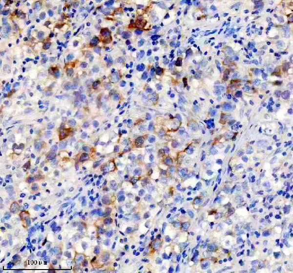 IHC analysis of TACC3 using anti-TACC3 antibody (M02876)