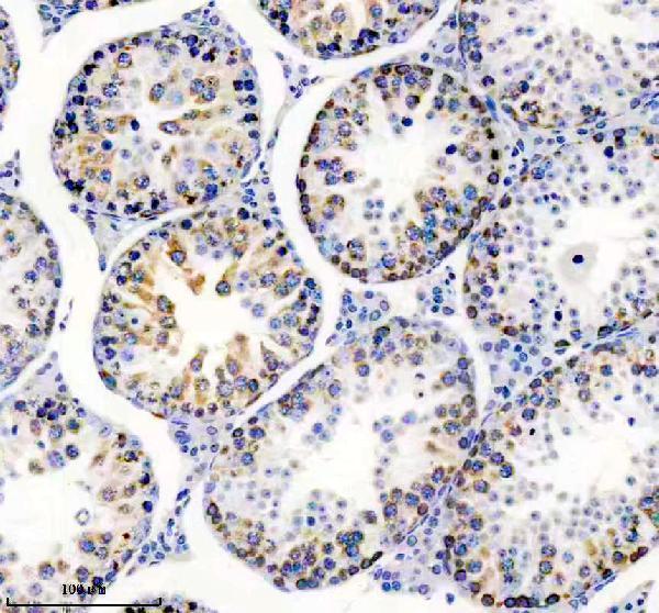 m02876 tacc3 primary antibodies ihc testing 3