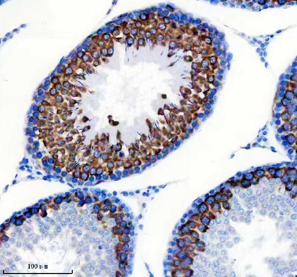 m02876 tacc3 primary antibodies ihc testing 4