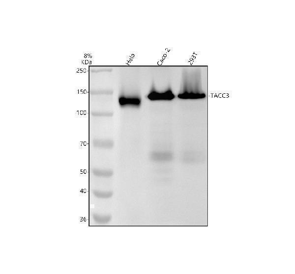 Western blot analysis of TACC3 using anti-TACC3 antibody (M02876)