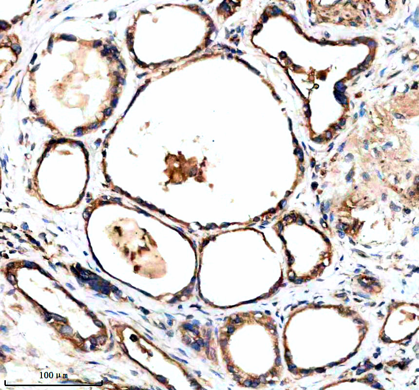 IHC analysis of ACVR1B using anti-ACVR1B antibody (M02882)