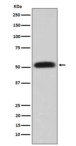 Western blot analysis of Glycerol kinase expression in HepG2 cell lysate