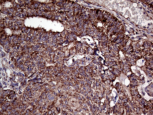 m02885 1 anti atg4b mouse monoclonal antibody clone id oti1a3 ihc testing 3