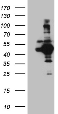 m02885 1 anti atg4b mouse monoclonal antibody clone id oti1a3 wb testing 1