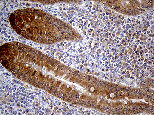 m02891 anti peroxiredoxin 5 prdx5 mouse monoclonal antibody clone id oti3b6 ihc testing 4