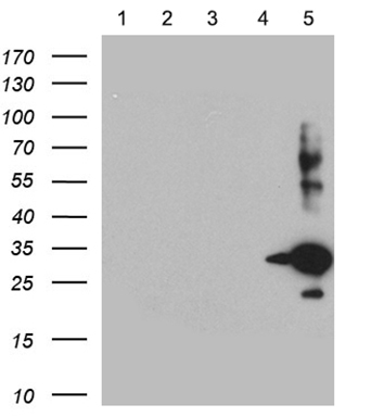 Equivalent amounts of lysates (5 ug per lane) of SSTR1