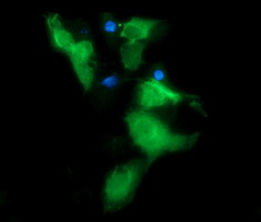 m02898 1 anti msi2 mouse monoclonal antibody clone id oti2f10 if testing 8
