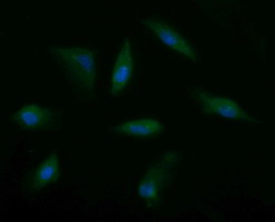 m02898 1 anti msi2 mouse monoclonal antibody clone id oti2f10 if testing 9