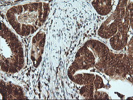 m02898 1 anti msi2 mouse monoclonal antibody clone id oti2f10 ihc testing 5
