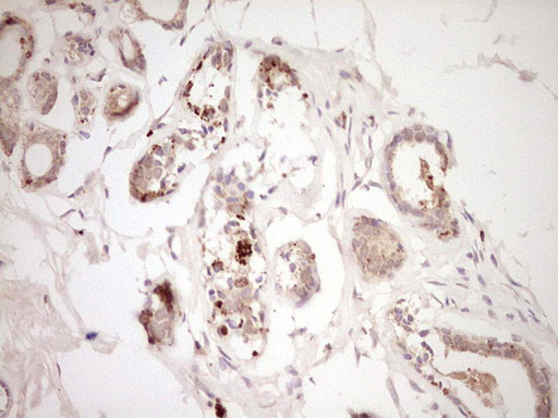 m02899 anti adamts4 mouse monoclonal antibody clone id oti6f8 ihc testing 2