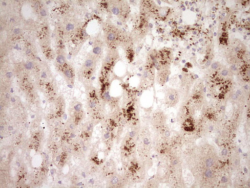 m02899 anti adamts4 mouse monoclonal antibody clone id oti6f8 ihc testing 4