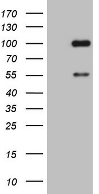 m02899 anti adamts4 mouse monoclonal antibody clone id oti6f8 wb testing 1