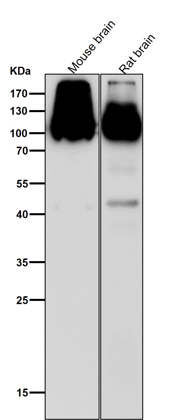 All lanes use the Antibody at 1:1K dilution for 1 hour at room temperature