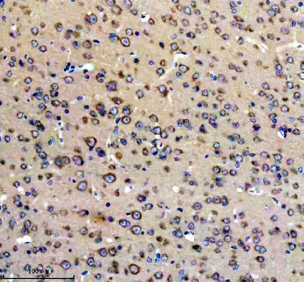 IHC analysis of GLUR2 using anti-GLUR2 antibody (M02905)