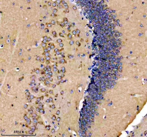 IHC analysis of GLUR2 using anti-GLUR2 antibody (M02905)
