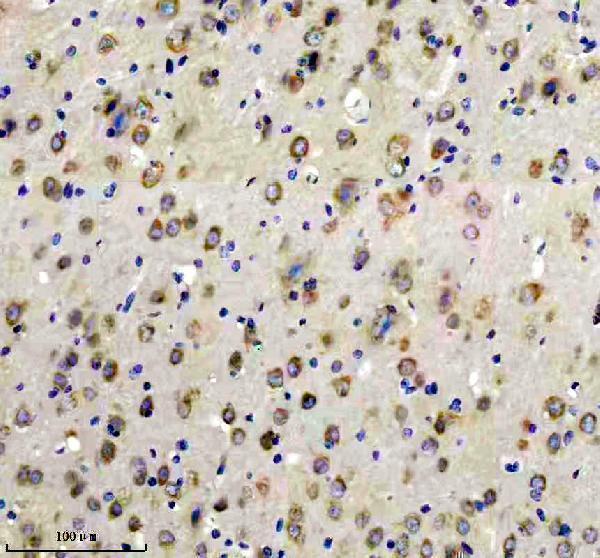 m02905 glur2 primary antibodies ihc testing 3