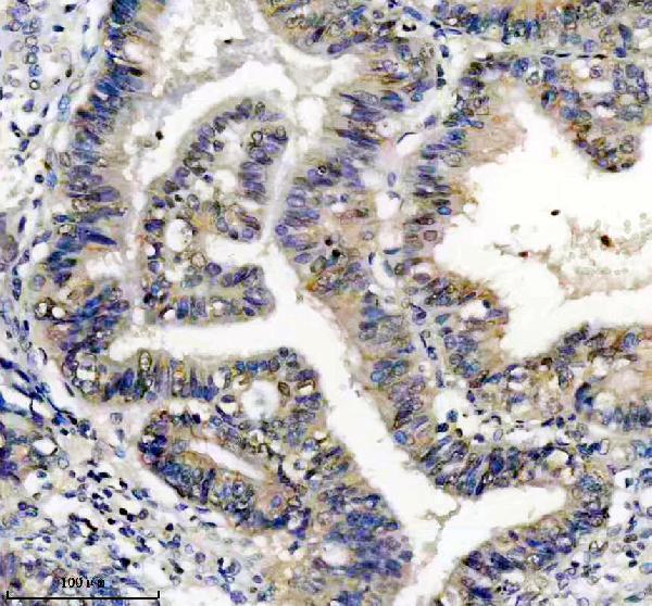 m02916 map2k3 primary antibodies ihc testing 1