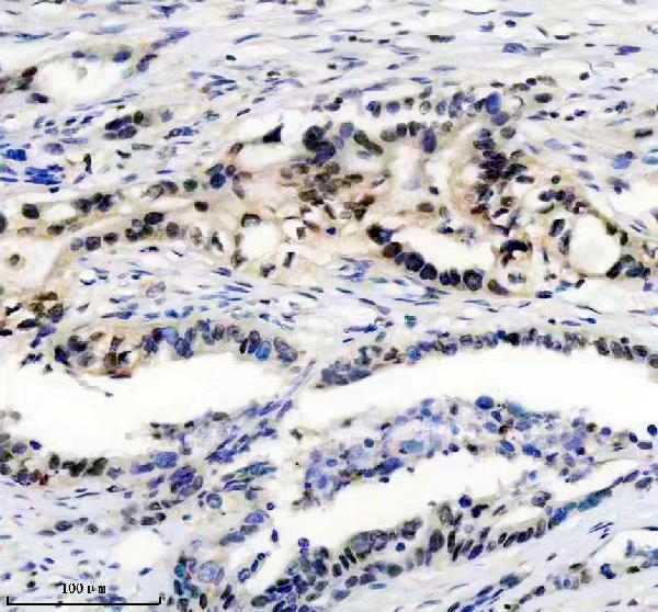m02916 map2k3 primary antibodies ihc testing 2
