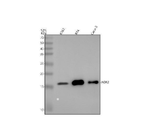 Western blot analysis of AGR2 using anti-AGR2 antibody (M02922)