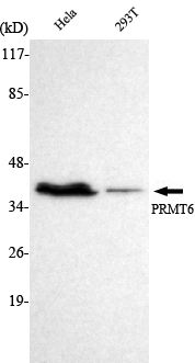 Western blotting validation for Anti-PRMT6 Monoclonal Antibody M02924-1
Western Blot (WB) analysis using PRMT6 Monoclonal Antibody against HeLa