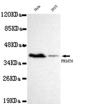 Western blot detection of PRMT6 in Hela&293T cell lysates using PRMT6 antibody (1:1000 diluted) 