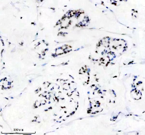 m02931 1 matr3 primary antibodies ihc testing 1