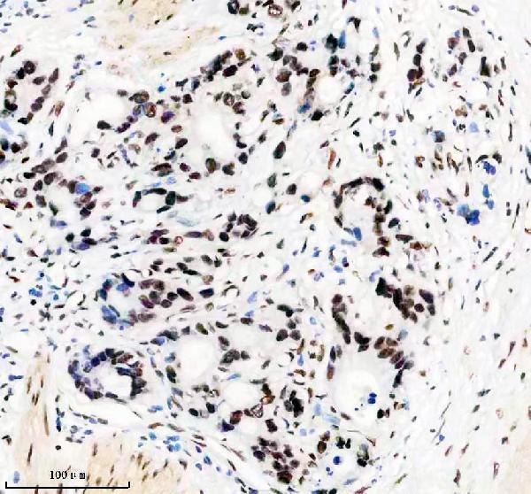 m02931 1 matr3 primary antibodies ihc testing 10