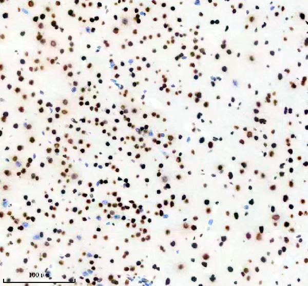 m02931 1 matr3 primary antibodies ihc testing 11
