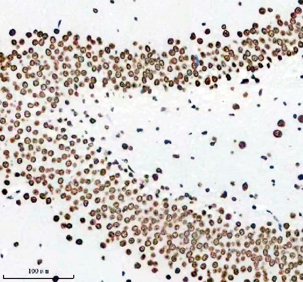 m02931 1 matr3 primary antibodies ihc testing 12