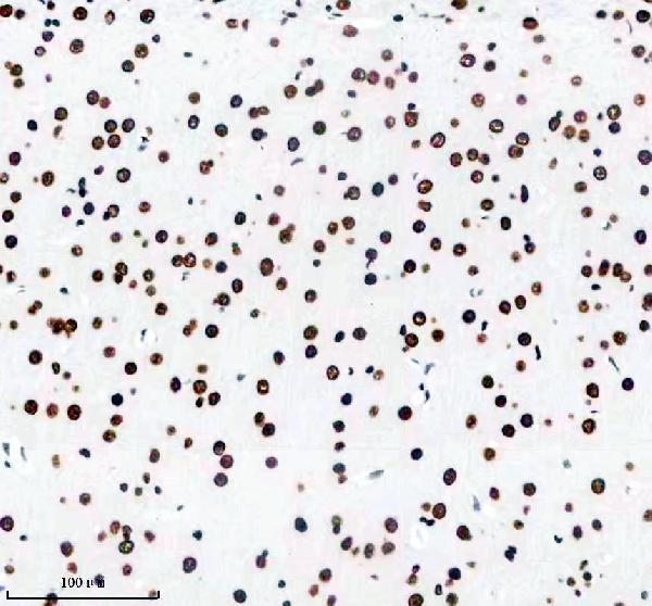 m02931 1 matr3 primary antibodies ihc testing 13