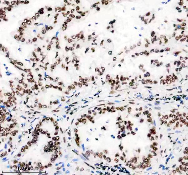 m02931 1 matr3 primary antibodies ihc testing 2