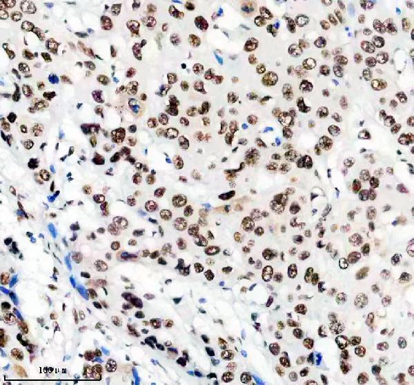 m02931 1 matr3 primary antibodies ihc testing 3