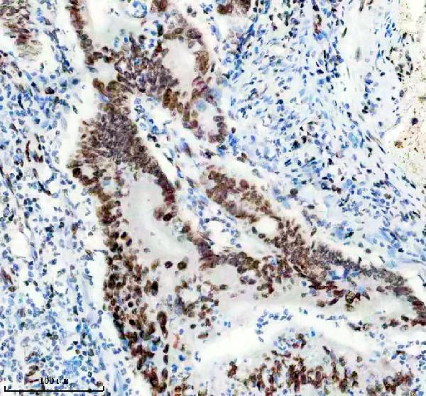 m02931 1 matr3 primary antibodies ihc testing 4