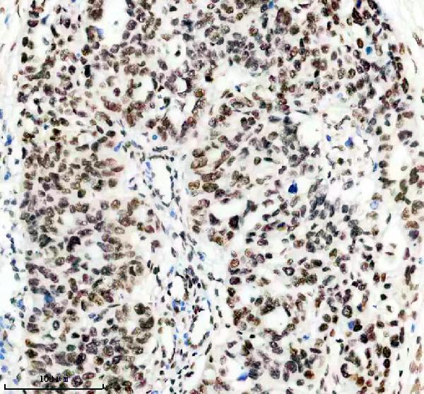m02931 1 matr3 primary antibodies ihc testing 5